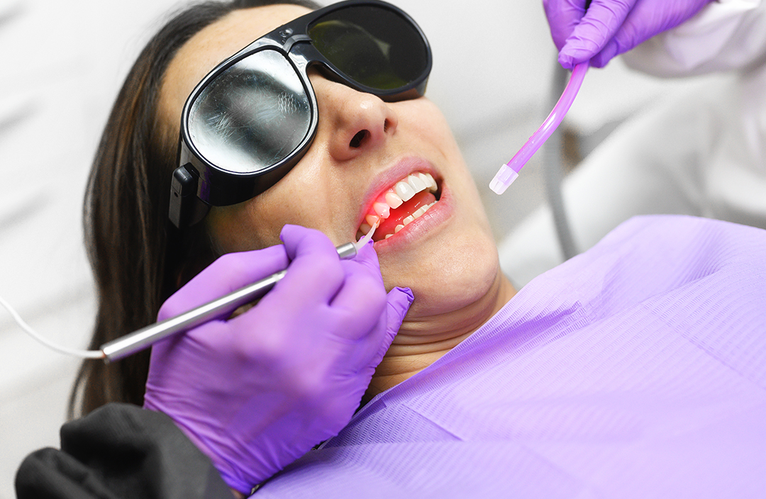 tratament paradontal laser