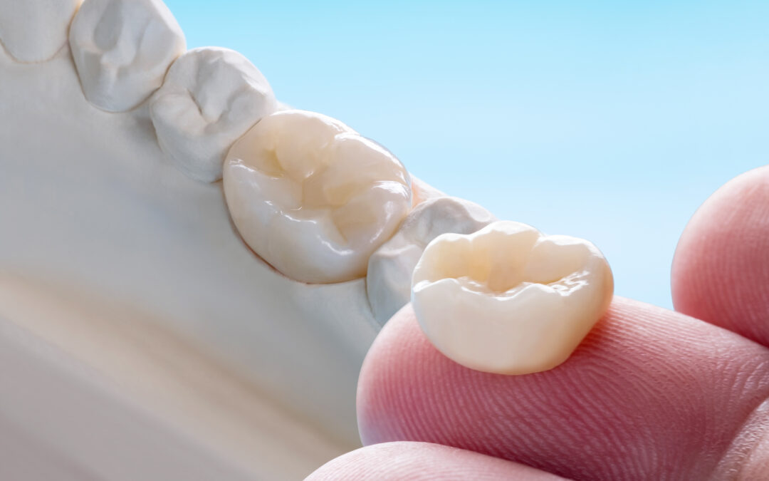 Coroanele dentare – solutia salvatoare pentru dintii devitalizati