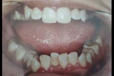 Pacient iaparat dentar