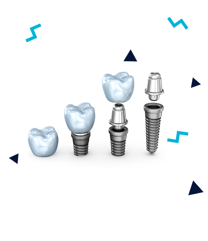 Cum se ingrijesc implanturile dentare?