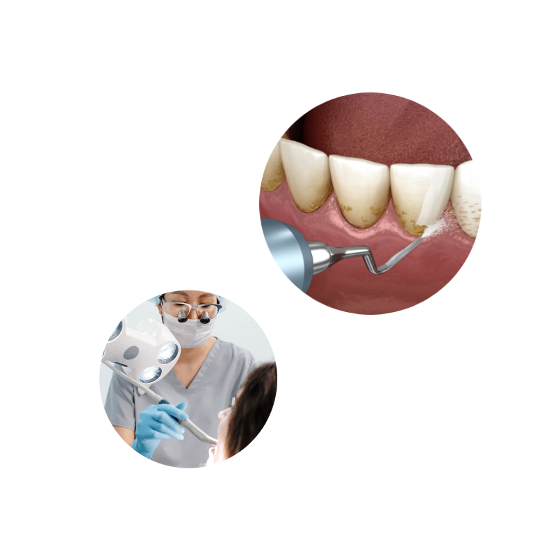 ce-este-igienizarea-dentara CE ESTE IGIENIZAREA DENTARA