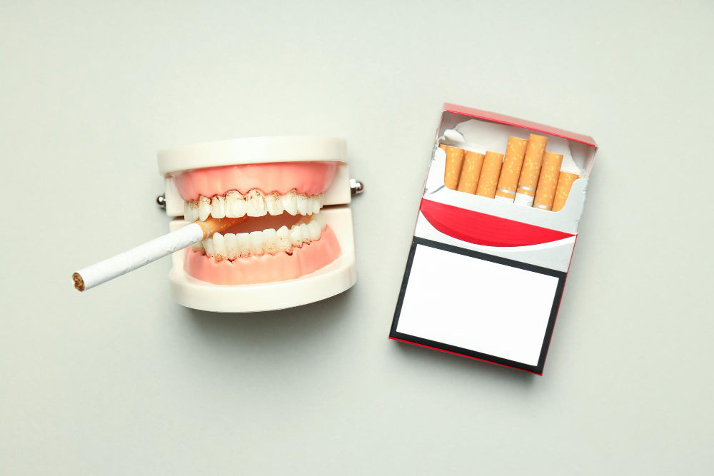 Efectele fumatului asupra sanatatii orale