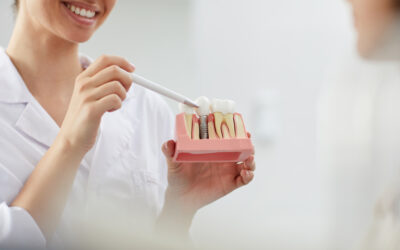 Pot face implant dentar daca am osteoporoza?