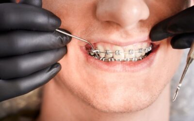 Gestionarea durerii in tratamentul ortodontic